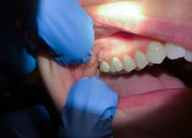 Best Emergency Orthodontic Repairs in Chico, TX